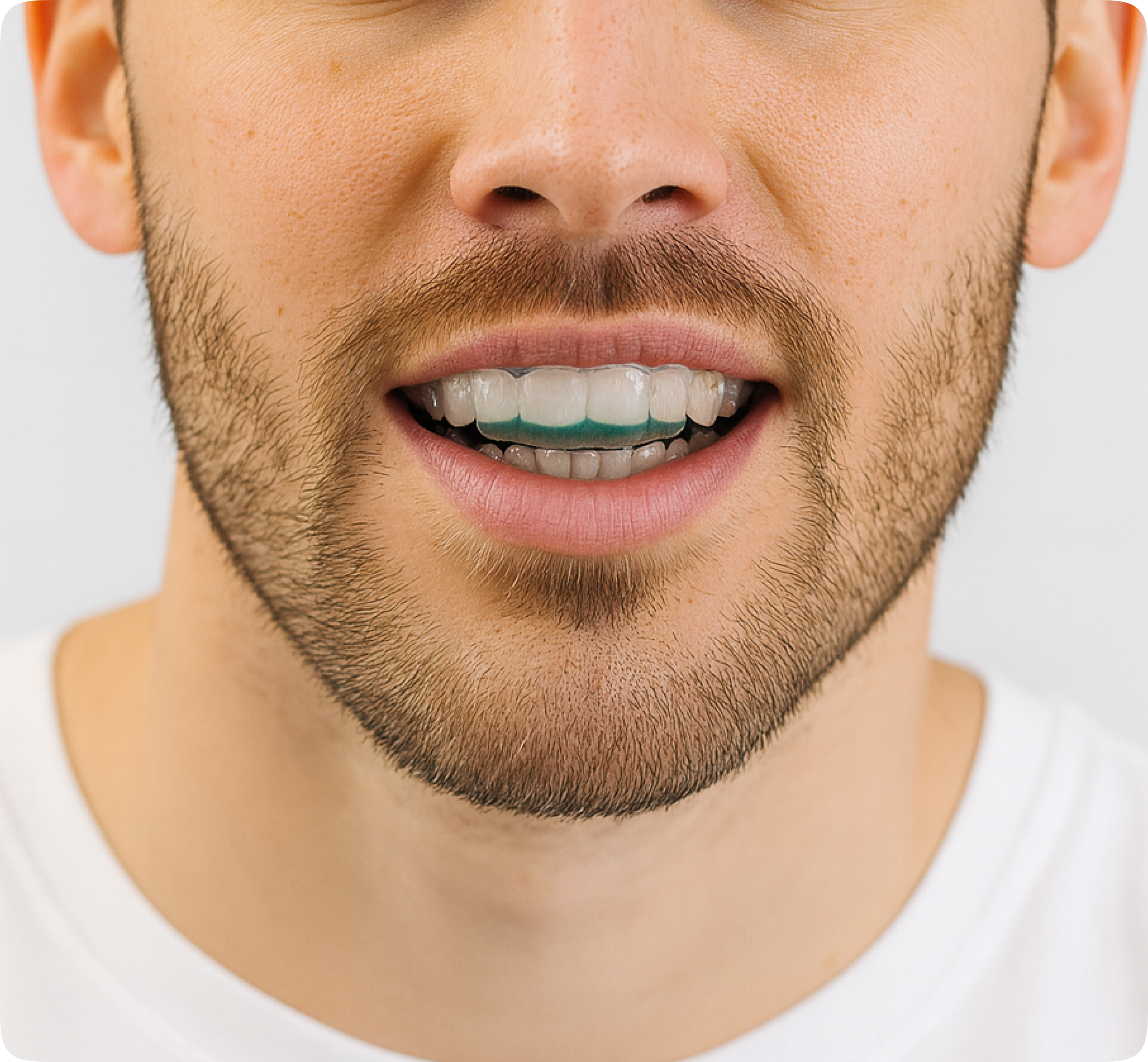 Placeholder for SnoreRx cleaning spray